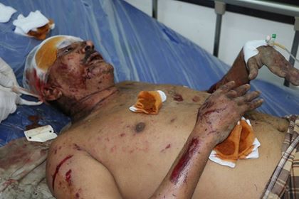 ضحايا سوق الهنود الحديدة