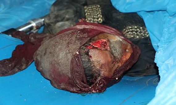 ضحايا سوق الهنود الحديدة