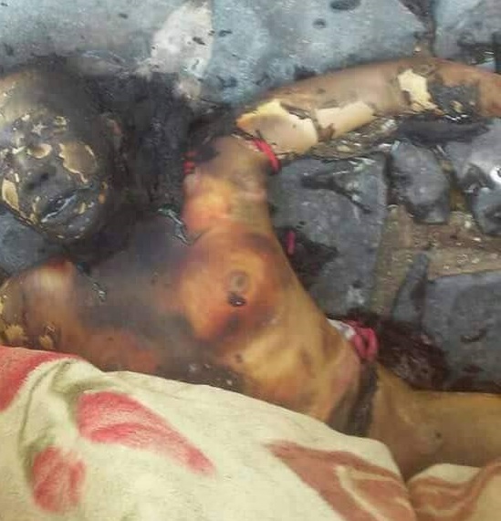 حقيقة جثة المرأة التي وجدت محروقة في مدينة تعز