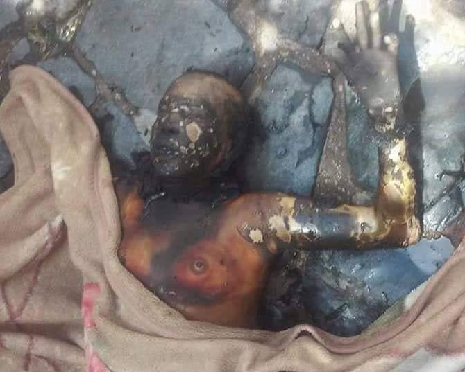 حقيقة جثة المرأة التي وجدت محروقة في مدينة تعز